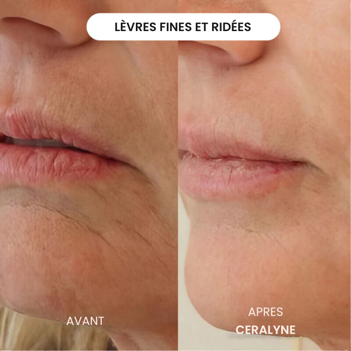 Transformez une peau terne avec le système de micro-infusion anti-âge