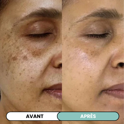Transformez une peau terne avec le système de micro-infusion anti-âge