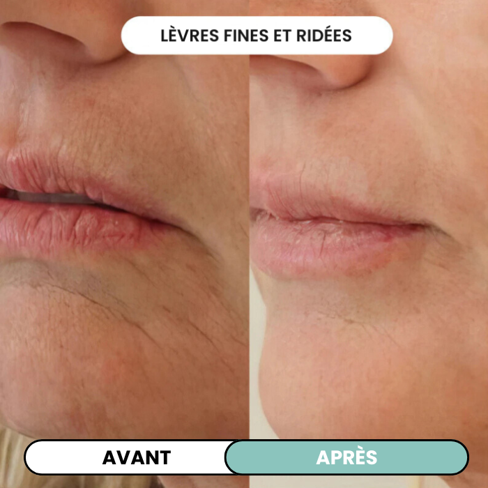 Transformez une peau terne avec le système de micro-infusion anti-âge